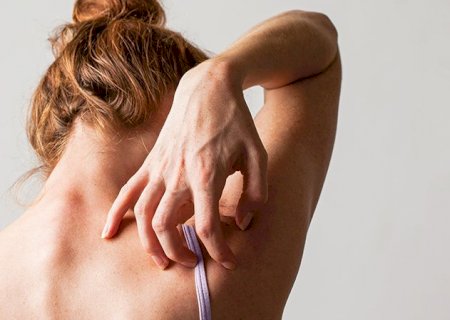 Como a coceira da dermatite atópica impacta a vida de crianças e adultos?