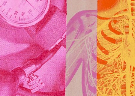 Veja cinco passos para controlar a pressão alta