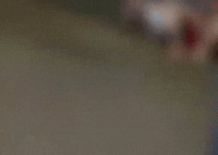 Mulher tem perna arrancada após ser atropelada e motorista foge